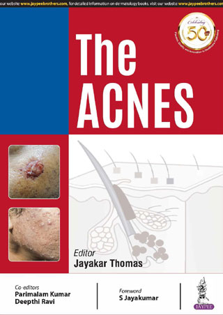 THE ACNES,1/E,JAYAKAR THOMAS