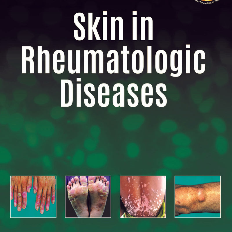 SKIN IN RHEUMATOLOGIC DISEASES,1/E,SAVITA YADAV