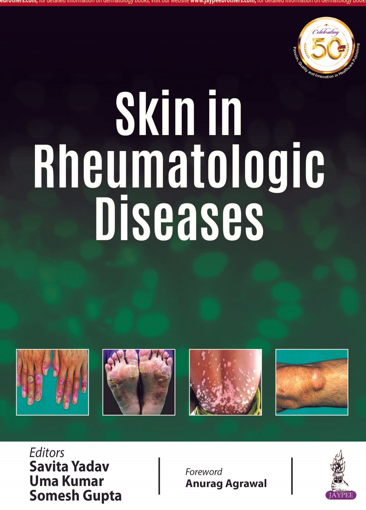 SKIN IN RHEUMATOLOGIC DISEASES,1/E,SAVITA YADAV