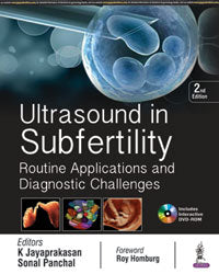 ULTRASOUND IN SUBFERTILITY ROUTINE APPLICATION,2/E,K JAYAPRAKASAN