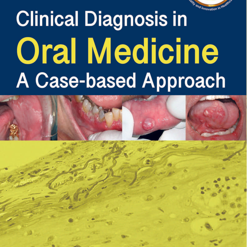 CLINICAL DIAGNOSIS IN ORAL MEDICINE: A CASE-BASED APPROACH
,1/E,SR PRABHU
