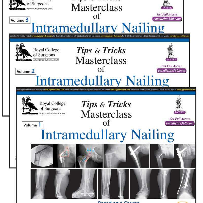 TIPS & TRICKS MASTERCLASS OF INTRAMEDULLARY NAILING (3 VOLUMES): BASED ON A COURSE ACCREDITED BY THE,1/E,SUBHASH CH HALDER