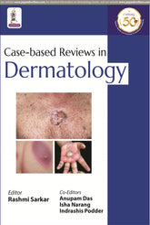 CASE-BASED REVIEWS IN DERMATOLOGY,1/E,RASHMI SARKAR