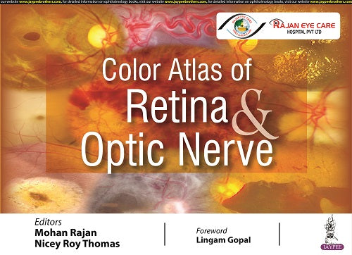 COLOR ATLAS OF RETINA & OPTIC NERVE,1/E,RAJAN MOHAN