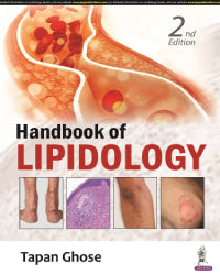 HANDBOOK OF LIPIDOLOGY 2/E by TAPAN GHOSE