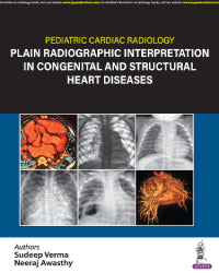 PEDIATRIC CARDIAC RADIOLOGY PLAIN RADIOGRAPHIC INTERPRETATION IN CONGENITAL AND STRUCTURAL HEART DIS 1/E by SUDEEP VERMA