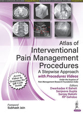 ATLAS OF INTERVENTIONAL PAIN MANAGEMENT PROCEDURES: A STEPWISE APPROACH, 1/E,  by DWARKADAS K BAHETI