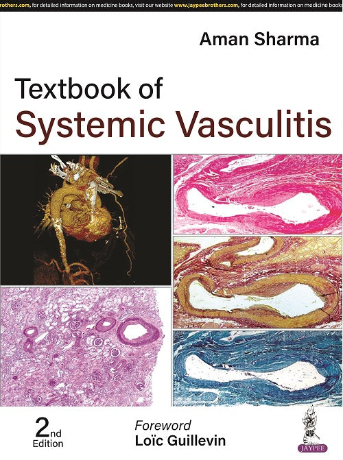 TEXTBOOK OF SYSTEMIC VASCULITIS, 2/E,  by AMAN SHARMA