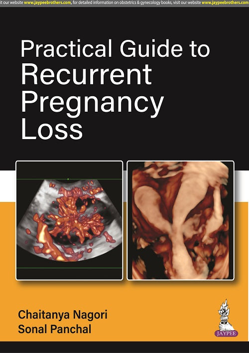 PRACTICAL GUIDE TO RECURRENT PREGNANCY LOSS, 1/E,  by CHAITANYA NAGORI