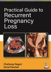PRACTICAL GUIDE TO RECURRENT PREGNANCY LOSS, 1/E,  by CHAITANYA NAGORI