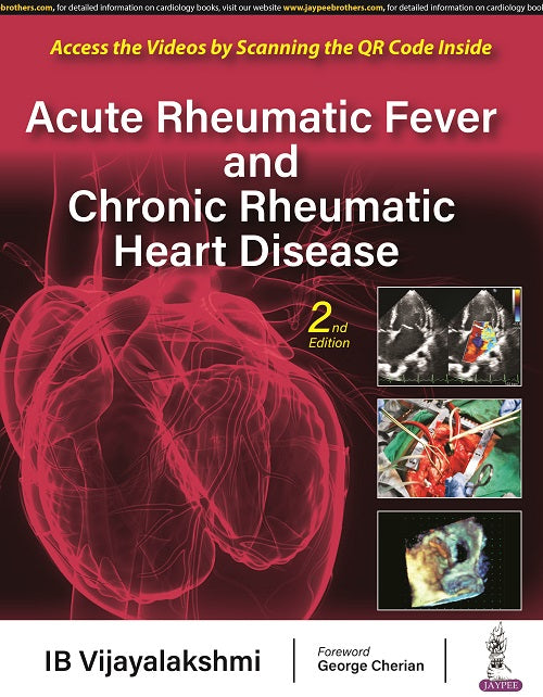 ACUTE RHEUMATIC FEVER AND CHRONIC RHEUMATIC HEART DISEASE, 2/E,  by IB VIJAYALAKSHMI