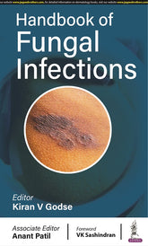 HANDBOOK OF FUNGAL INFECTIONS, 1/E,  by KIRAN V GODSE