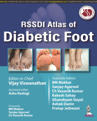 RSSDI ATLAS OF DIABETIC FOOT 1/E by VIJAY VISWANATHAN