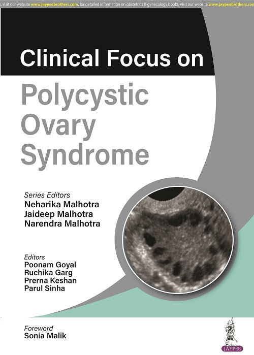 CLINICAL FOCUS ON POLYCYSTIC OVARY SYNDROME, 1/E,  by NEHARIKA MALHOTRA