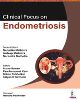 CLINICAL FOCUS ON ENDOMETRIOSIS 1/E by NEHARIKA MALHOTRA