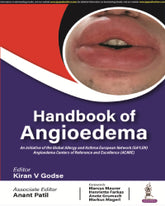 HANDBOOK OF ANGIOEDEMA 1/E by KIRAN V GODSE