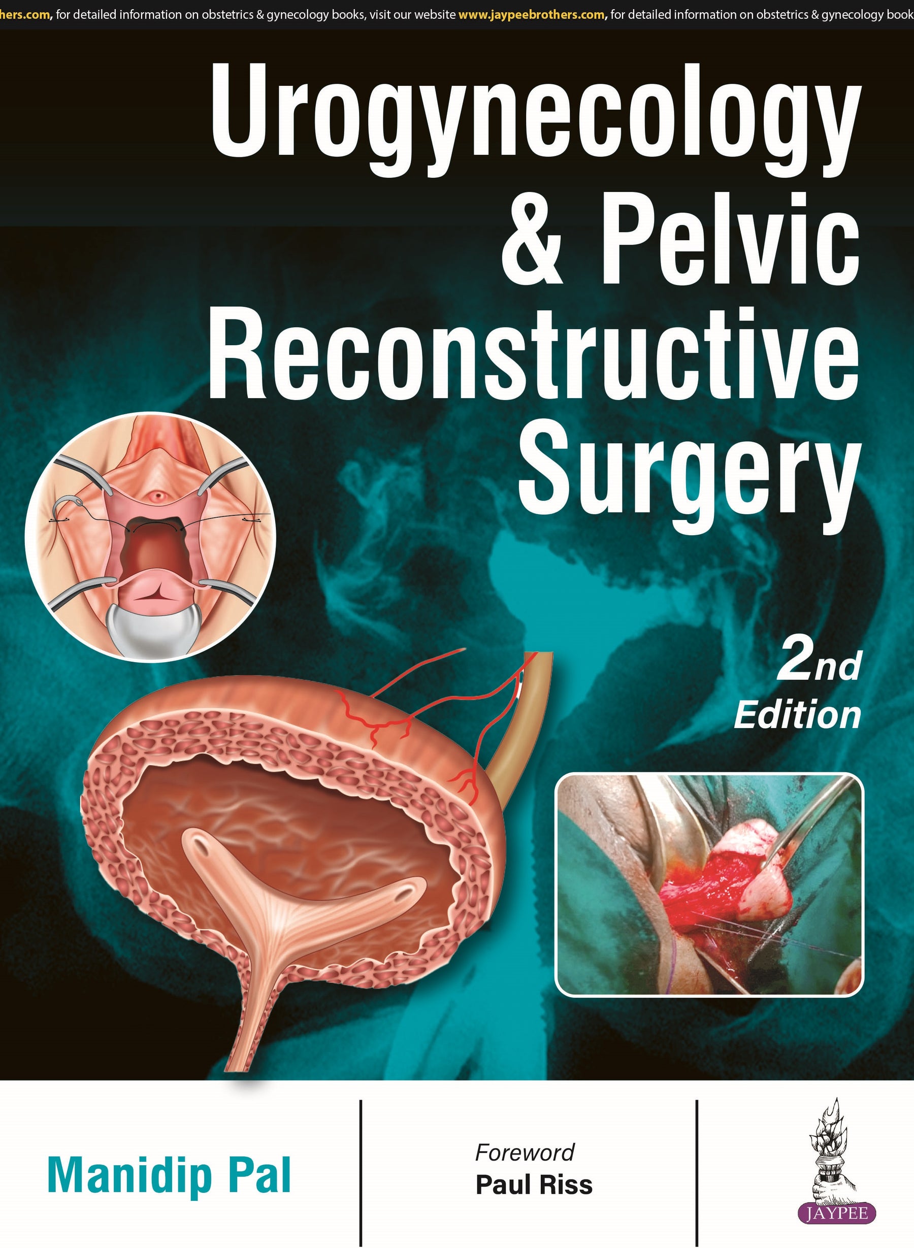 UROGYNECOLOGY & PELVIC RECONSTRUCTIVE SURGERY 2/E by MANIDIP PAL