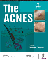 THE ACNES 2/E by JAYAKAR THOMAS