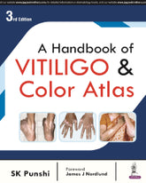 A HANDBOOK OF VITILIGO & COLOR ATLAS 3/E by SK PUNSHI