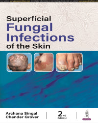 SUPERFICIAL FUNGAL INFECTIONS OF THE SKIN 2/E by ARCHANA SINGAL