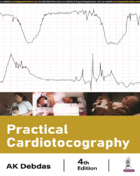 PRACTICAL CARDIOTOCOGRAPHY 4/E by AK DEBDAS