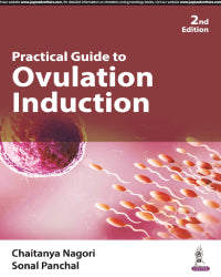 PRACTICAL GUIDE TO OVULATION INDUCTION 2/E by CHAITANYA NAGORI