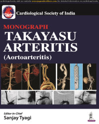 CSI MONOGRAPH TAKAYASU ARTERITIS (AORTOARTERITIS) 1/E by SANJAY TYAGI