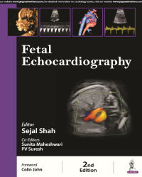 FETAL ECHOCARDIOGRAPHY 2/E by SEJAL SHAH