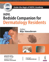 IADVL BEDSIDE COMPANION FOR DERMATOLOGY RESIDENTS 1/E by BIJU VASUDEVAN