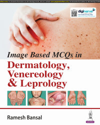 IMAGE BASED MCQ'S IN DERMATOLOGY, VENEREOLOGY & LEPROLOGY 1/E by RAMESH BANSAL