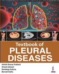 TEXTBOOK OF PLEURAL DISEASES 1/E by ASHISH KUMAR PRAKASH