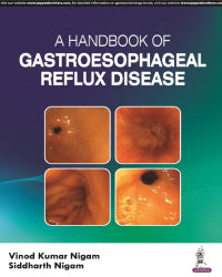 A HANDBOOK OF GASTROESOPHAGEAL REFLUX DISEASE 1/E by VINOD KUMAR NIGAM