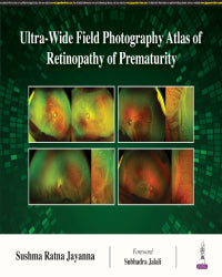 ULTRA- WIDE FIELD PHOTOGRAPHY ATLAS OF RETINOPATHY OF PREMATURITY 1/E by SUSHMA RATNA JAYANNA
