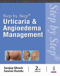 STEP BY STEP URTICARIA AND ANGIOEDEMA MANAGEMENT 2/E by SANJAY GHOSH