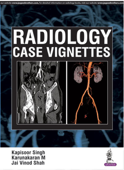 RADIOLOGY CASE VIGNETTES,1/E,KAPISOOR SINGH