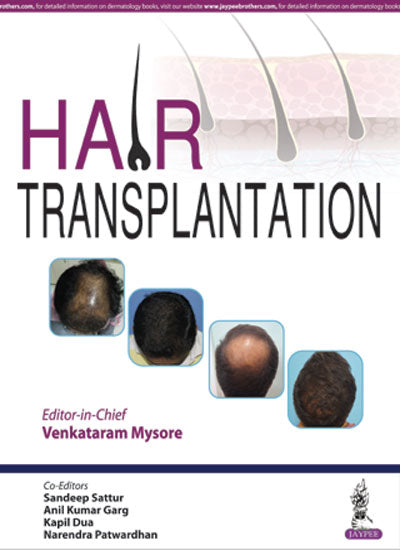 HAIR TRANSPLANTATION,1/E,VENKATARAM MYSORE