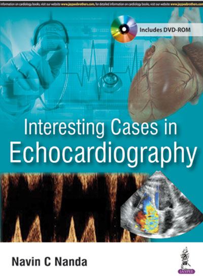 INTERESTING CASES IN ECHOCARDIOGRAPHY INCLUDES DVD-ROM,1/E,NAVIN C NANDA