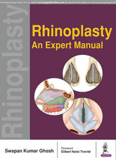 RHINOPLASTY AN EXPERT MANUAL,1/E,SWAPAN KUMAR GHOSH