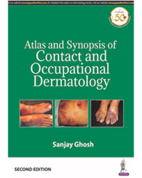 ATLAS AND SYNOPSIS OF CONTACT AND OCCUPATIONAL DERMATOLOGY,2/E,SANJAY GHOSH