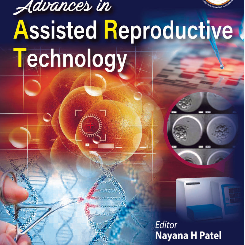 ADVANCES IN ASSISTED REPRODUCTIVE TECHNOLOGY,1/E,NAYANA H PATEL