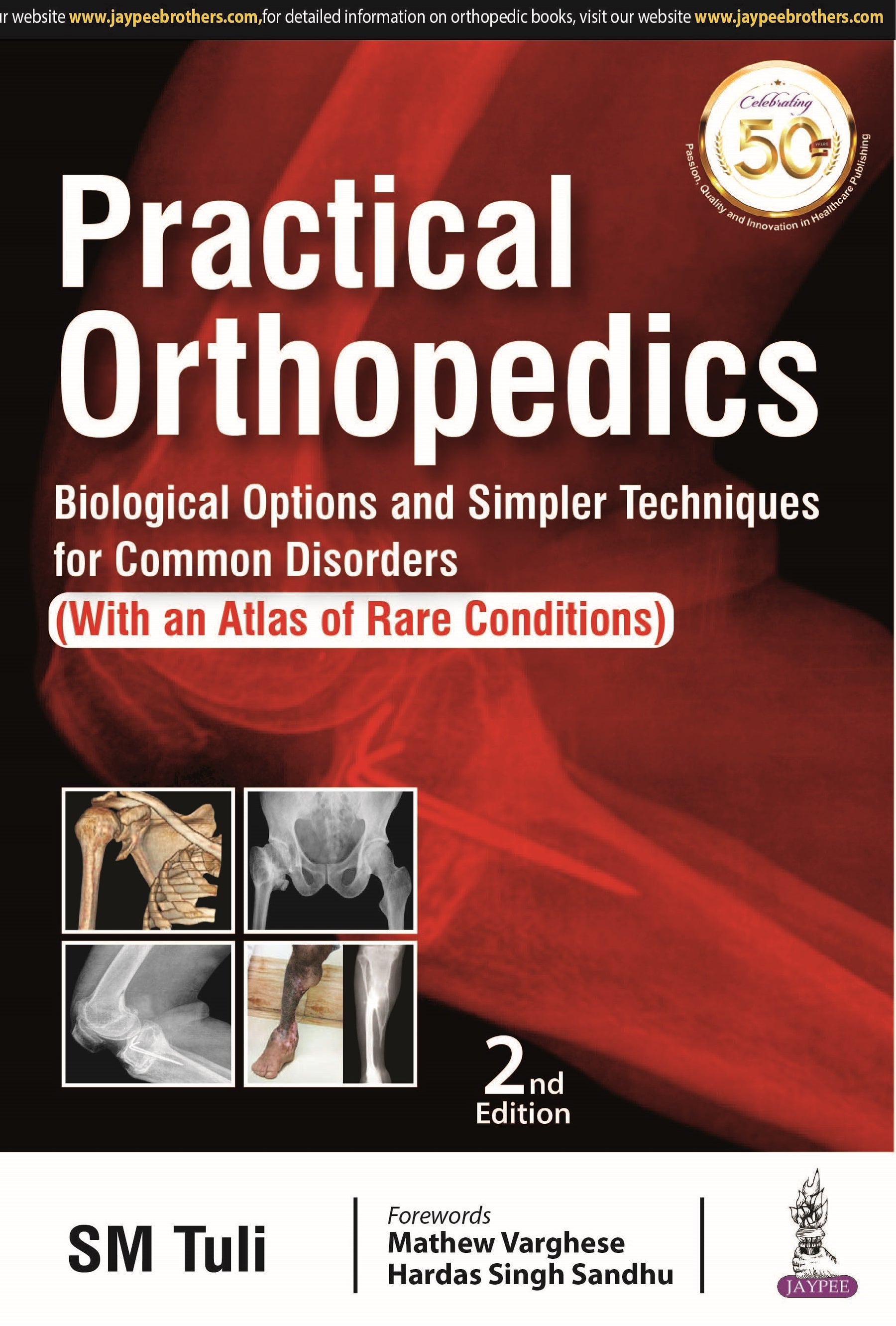 PRACTICAL ORTHOPEDICS: BIOLOGICAL OPTIONS AND SIMPLER TECHNIQUES FOR COMMON DISORDERS (WITH AN ATLAS,2/E,SM TULI