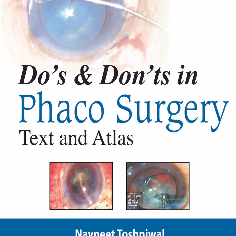 DO’S & DON’TS IN PHACO SURGERY: TEXT AND ATLAS
,1/E,NAVNEET TOSHNIWAL