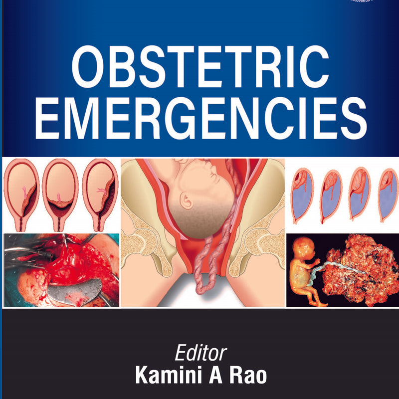 OBSTETRIC EMERGENCIES,3/E,KAMINI A RAO