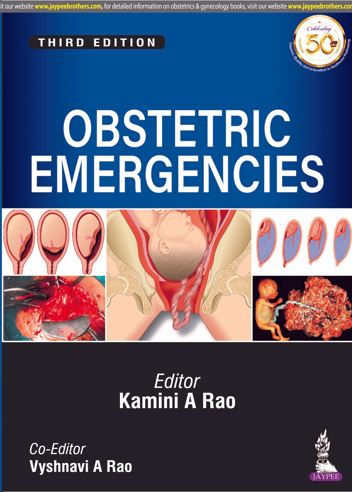 OBSTETRIC EMERGENCIES,3/E,KAMINI A RAO