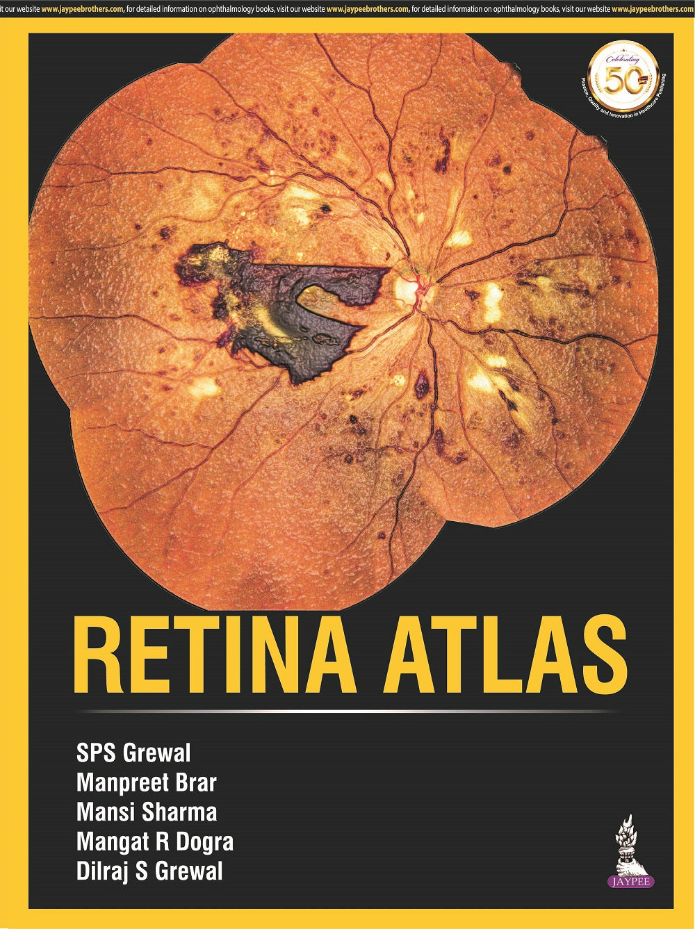 RETINA ATLAS,1/E,SPS GREWAL