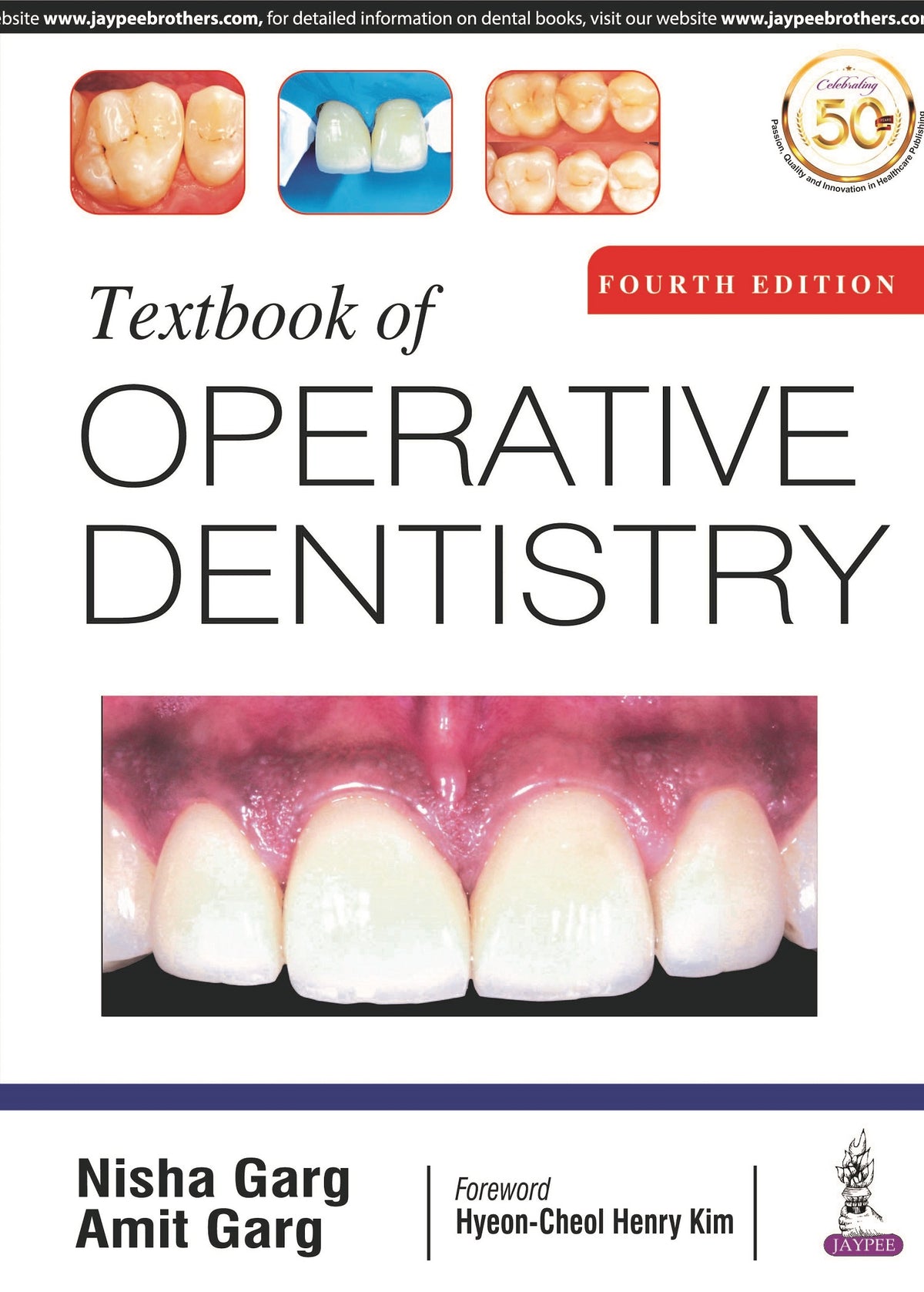 TEXTBOOK OF OPERATIVE DENTISTRY,4/E,NISHA GARG