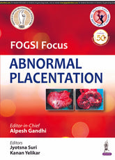 FOGSI FOCUS ABNORMAL PLACENTATION,1/E,ALPESH GANDHI