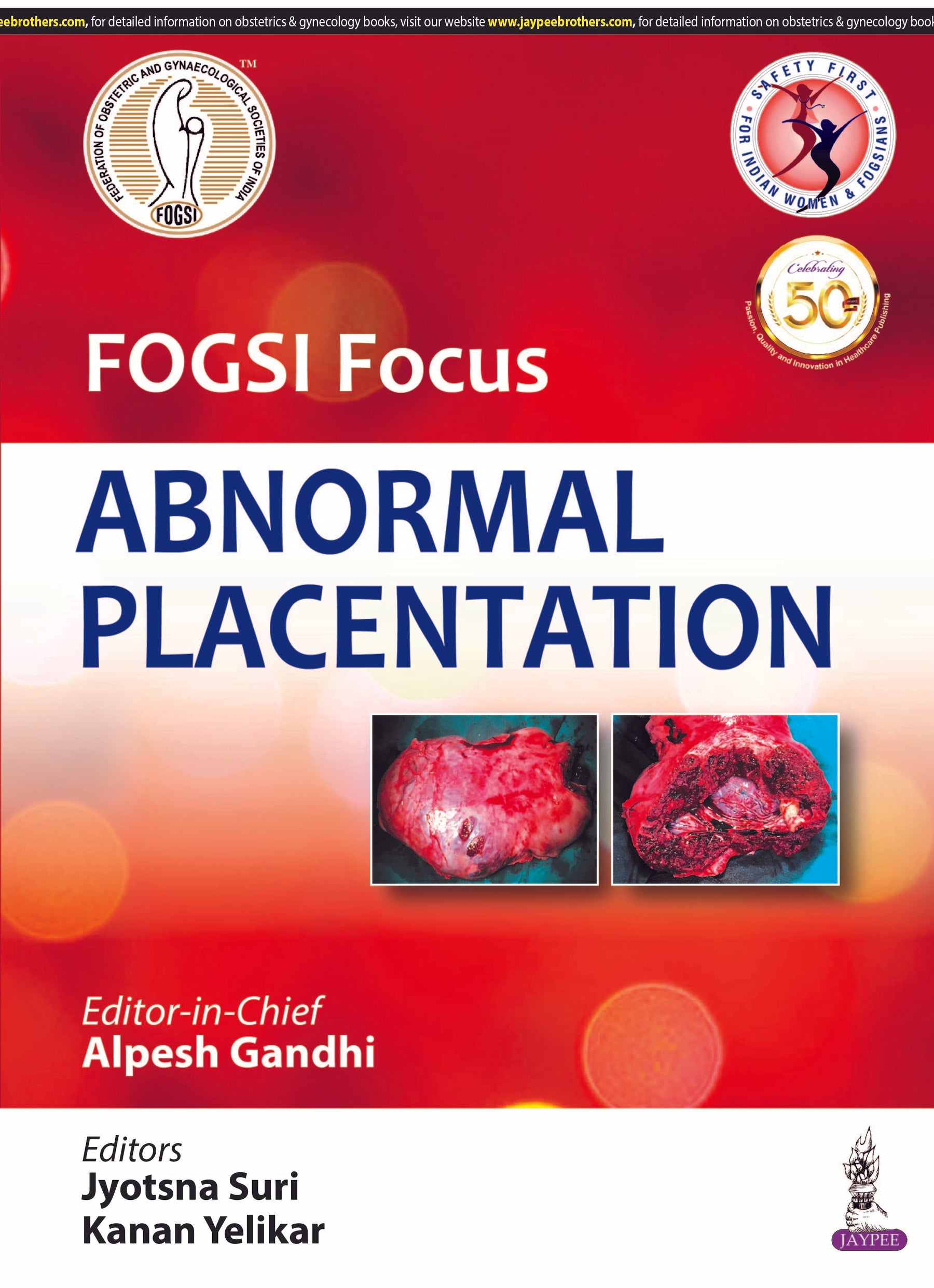 FOGSI FOCUS ABNORMAL PLACENTATION,1/E,ALPESH GANDHI