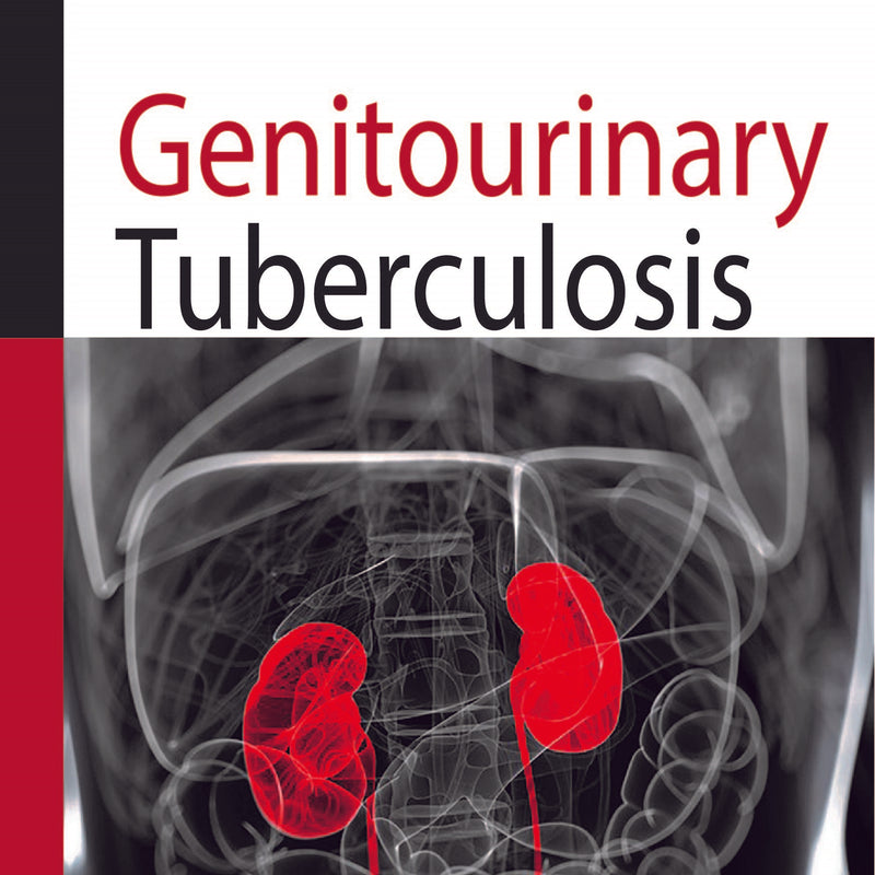GENITOURINARY TUBERCULOSIS,1/E,GANESH GOPALAKRISHNAN
