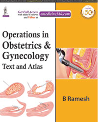 OPERATIONS IN OBSTETRICS & GYNECOLOGY: TEXT AND ATLAS,1/E,B RAMESH